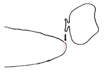 shoe patches for toe holes