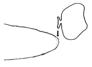 shoe patches for toe holes